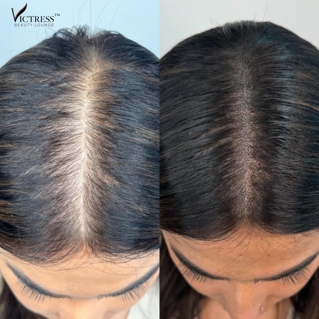 Permanent Makeup